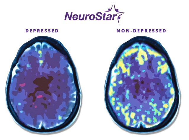 White-Mark-George-Brain-Scan-Image